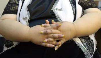  Las mujeres con sobrepeso tienen más riesgo que no le detecten un cáncer de mama 
