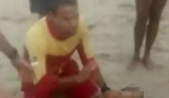 Hombre pierde su pene tras ataque de tiburón en Brasil 