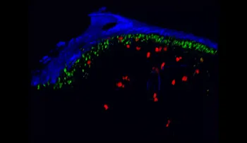 El VIH moviéndose por el cuerpo en tiempo real (VIDEO)