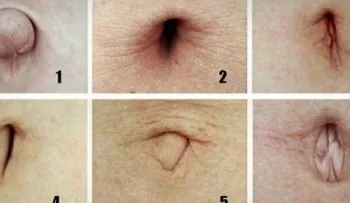 ¿Qué dice la forma de tu ombligo sobre tu salud?