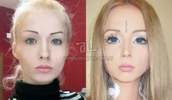 La barbie humana: cómo era antes de su cirugía?