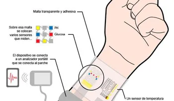  Tecnología permite medir la glucosa sin pinchazos para controlar la diabetes 