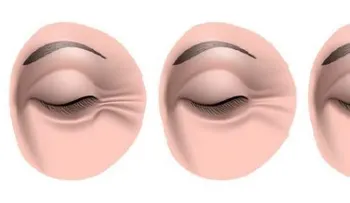 Tres ingredientes naturales para reducir las arrugas de los ojos 