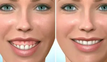 La cirugía ortognática, una intervención que devuelve sonrisas