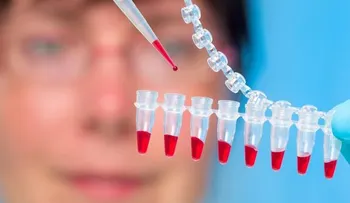 Unos ansiolíticos podrían vincularse con el riesgo de Alzheimer.