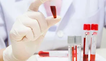 Una molécula de la sangre es efectiva contra enfermedad autoinmune del riñón