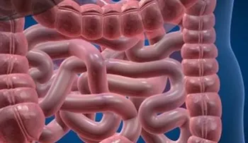 Enfermedades intestinales crónicas pueden se tratadas con trasplantes fecales 