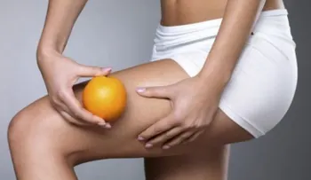 ¡Toma nota! Tratamientos efectivos para la celulitis