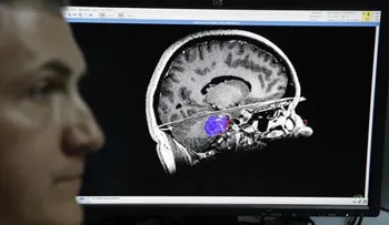 Crean cerebro artificial capaz de aprender por sí mismo