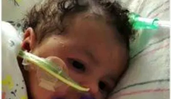 La chichí Astrid ya no está en coma, está consciente