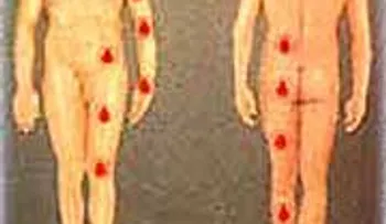 Enfermedades de los distintos aparatos del cuerpo humano