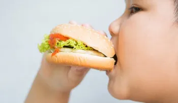 ¿Cómo evitar la obesidad infantil?