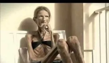DIOS MIO, nunca intente adelgazar de esta forma: mira el mal estado de esta mujer famosa (VIDEO)