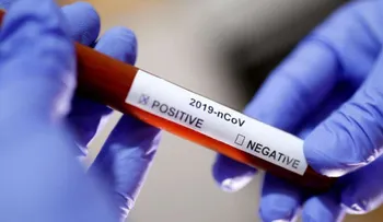 Se incrementa a 520 cantidad de fallecidos por coronavirus en RD; contagiados 18,319