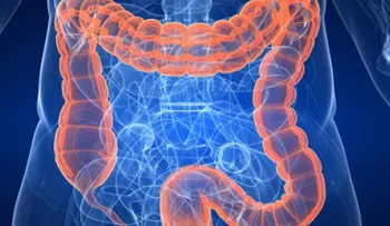Mucha carne y poca fibra, combinación riesgosa para el colon
