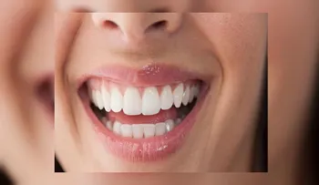 Remedios Caseros para Dientes sensibles