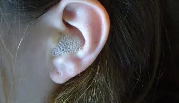 ¡Sólo 3 gotas de este remedio en el oído, dan un efecto increíble!