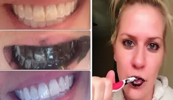 Garantizado para blanquear los dientes en siete días 