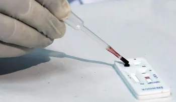 OMS dice test de diagnóstico de Zika podría estar disponible en semanas