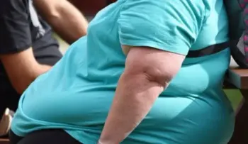 Sobrepeso y obesidad alcanzan proporciones "epidémicas" en Europa, alerta OMS