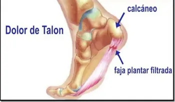 Esto es lo que le pasa a tu cuerpo si te duele el talón al despertarte o cuando estás de pie