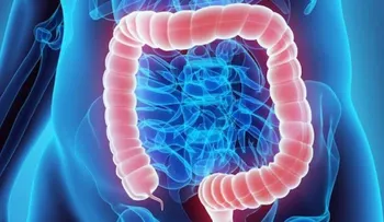 El cáncer colorrectal o de colon, el segundo más mortal en el 2020, con 935 mil muertes