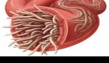 Albahaca en ayunas, granada y otros remedios para eliminar lombrices de los intestinos 