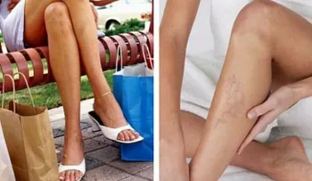 Esta es la razón por la que cruzar las piernas está perjudicando tu salud