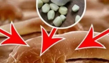 Remedio para eliminar los parasitos y la amebas