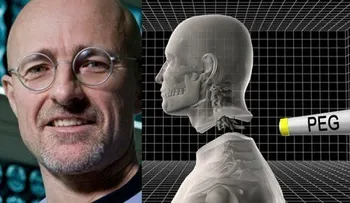 Neurocientífico asegura que el trasplante de cabeza ya es una realidad