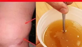 Esta es la mejor receta para sanar tus rodillas y reconstruir huesos y articulaciones