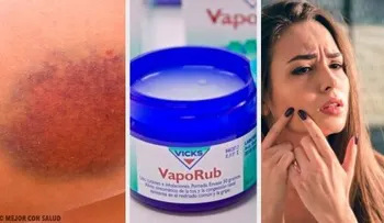 El VICKS VAPORUB y sus increíbles usos hasta en la vida sexual. Ver enlace del video