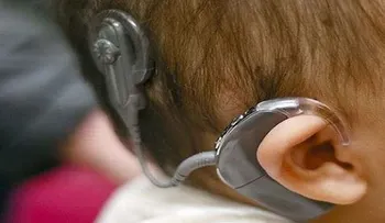 Consiguen activar un implante coclear a distancia por COVID-19 