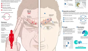 Un nuevo tratamiento para combatir la migraña con cirugía (VIDEO)