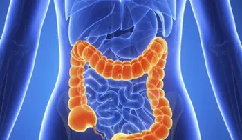 Cáncer de colon es la 4ta muerte por enfermedad oncológica