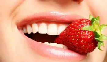 ¡A sonreír! Los alimentos que blanquean tus dientes 