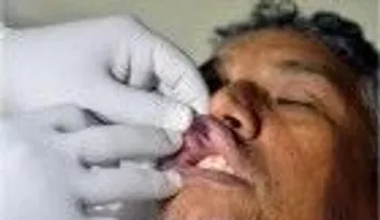 Operan del labio superior a Danny Polanco