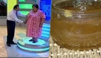 Esta mujer tenía graves problemas de salud por su sobrepeso hasta que un doctor le dio esta receta que le salvó la vida