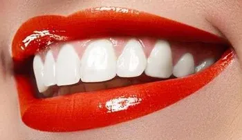 4 reglas de oro para evitar que el herpes labial se forme
