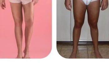 Hombre gasta 400 mil dólares para parecerse al Ken de la barbie