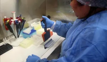 Adolescente venezolano es el primer caso de zika en Perú