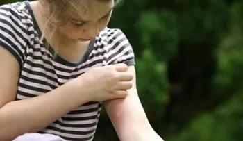 ¿Por qué te pican los mosquitos más que a nadie?