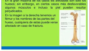 ¿Sabías que cada 3 segundos ocurre una fractura osteoporótica?