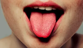 Siete problemas de salud que puedes detectar mirando tu lengua