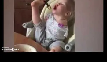 Un bebé sin brazos aprendió a comer con los pies