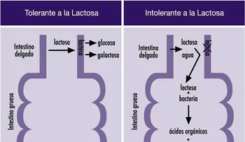  Señales de intolerancia hacia la lactosa 