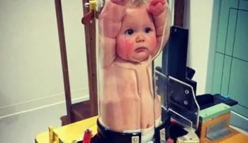 El dispositivo para hacer radiografías a niños, que enloquece a las redes