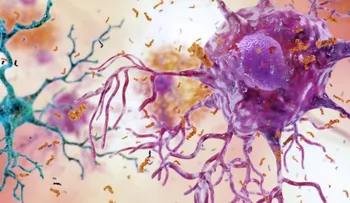Neurólogos buscan dar con una terapia exitosa para atacar el Alzheimer