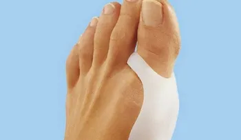 7 cuidados básicos para tus pies si tienes juanetes