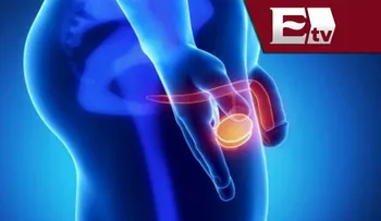 Cáncer de próstata: Síntomas y Factores de riesgo